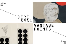 Cerebral Vantage Points